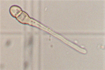 Portrait sommaire de la tolérance de différentes populations de Venturia inaequalis aux fongicides commerciaux utilisés pour réprimer la tavelure du pommier.