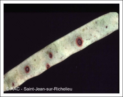 Colletotrichum lindemuthianum