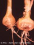 Fusarium oxysporum f. sp. cepae 